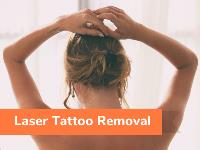 The Tattoo Removal Experts image 4